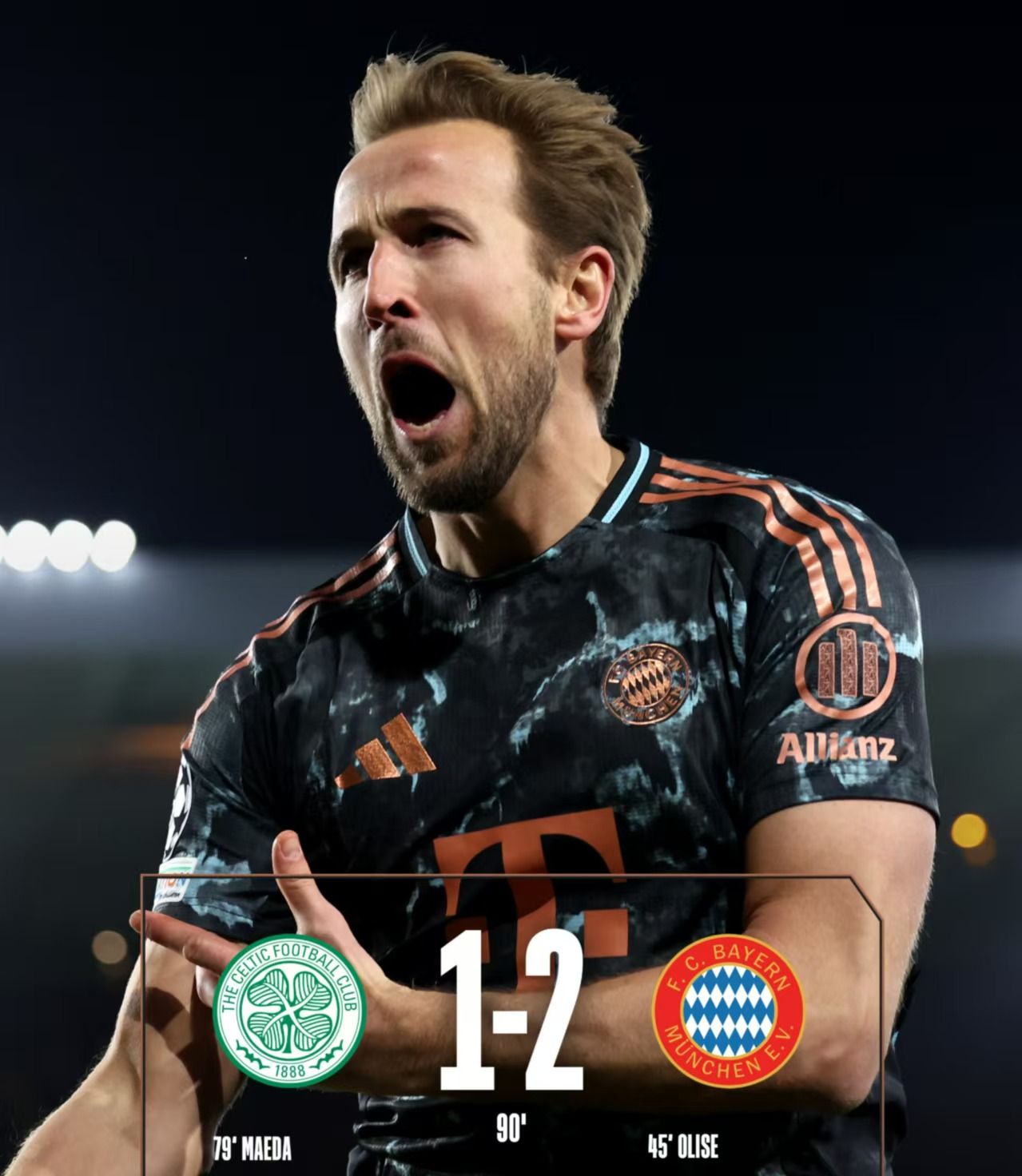 英雄联盟投注-今夜社区盾传出新动向；拜仁慕尼黑篮板制胜；管理层表态——底气十足；临场指挥获称赞(拜仁慕尼黑新赛季球衣)